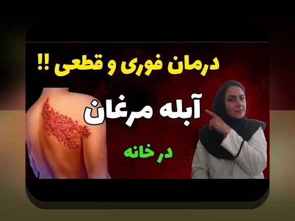 آیا زونا واگیر دارد؟ راهنمای کامل درباره نگرانی‌های رایج و حقیقت بیماری زونا در زندگی روزمره